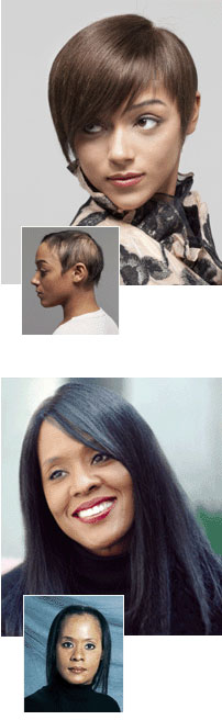 female pattern baldness. hair replacement systems. long island ny