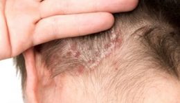 blog-hair-solution blog-hair-solution