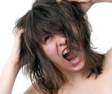 Woman with inflamed scalp in Long Island, New York