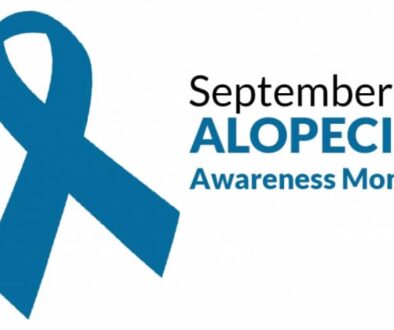 alopecia--month